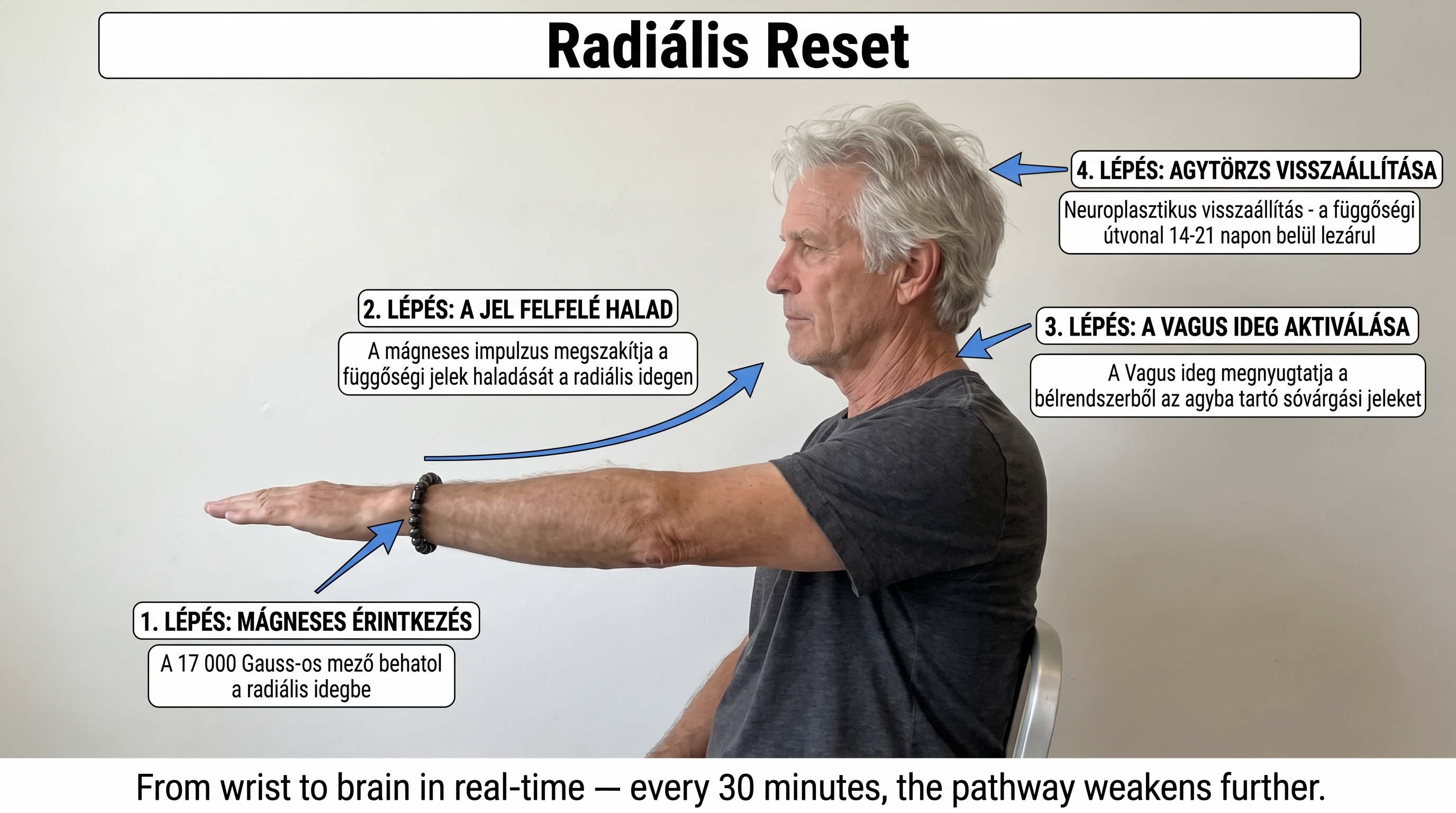 Infografika: cztery kroki Resetu Radialnego